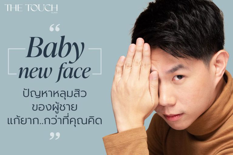 รักษาหลุมสิว กวนใจด้วย BABY NEW FACE ปัญหาหลุมสิวบนใบหน้าคุณ คือเรื่องสิวๆ ของเรา