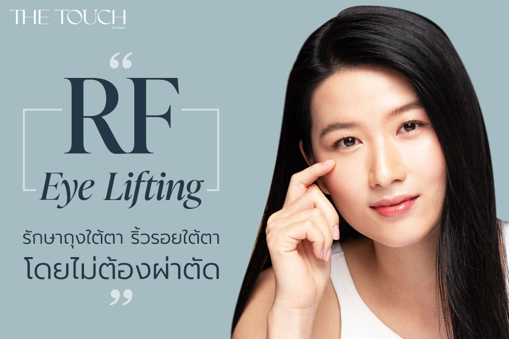 RF Eye Lifting รักษา ถุงใต้ตา ริ้วรอยใต้ตา โดยไม่ต้องผ่าตัด