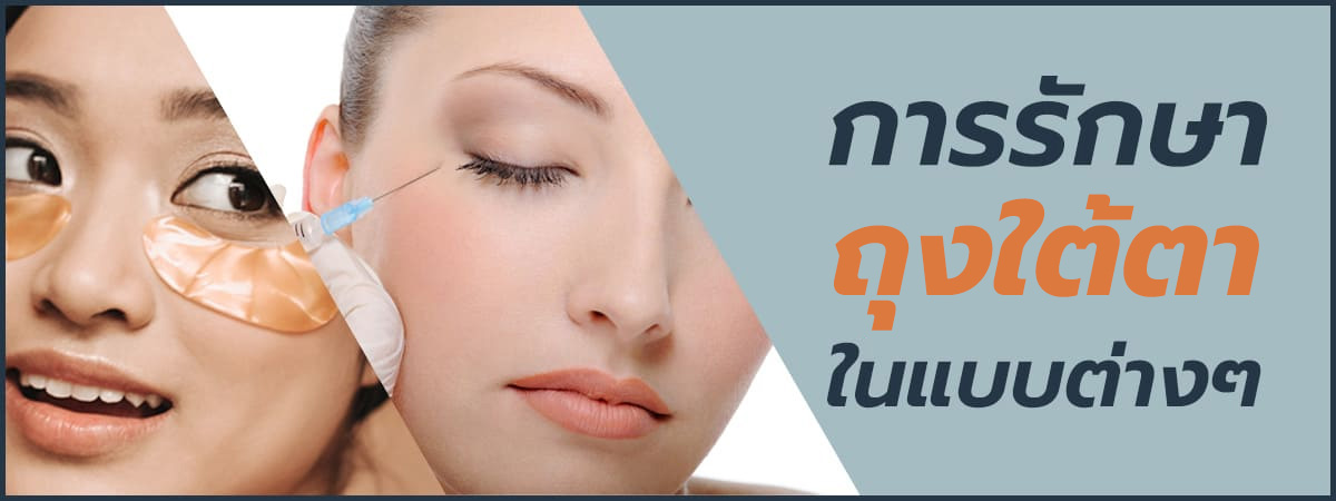 วิธีรักษาถุงใต้ตาด้วย RF Eye Lifting