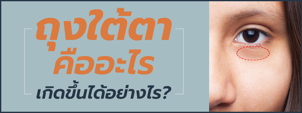 ปัญหาถุงใต้ตาบวมและวิธีรักษา