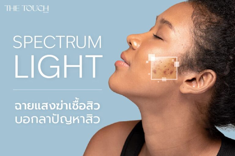 Spectrum Light ฉายแสงฆ่าเชื้อสิว บอกลาปัญหาสิวอักเสบเรื้อรัง