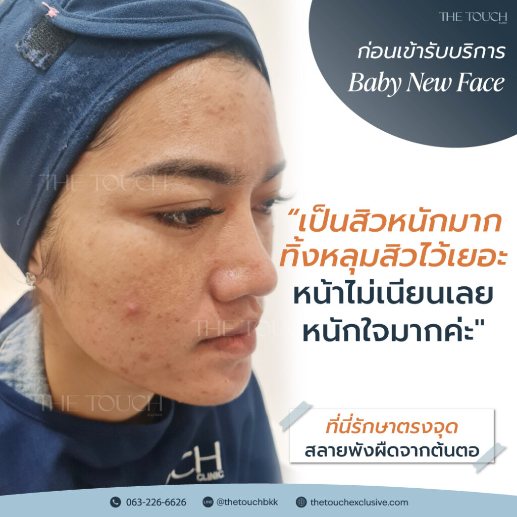 review-baby-new-face