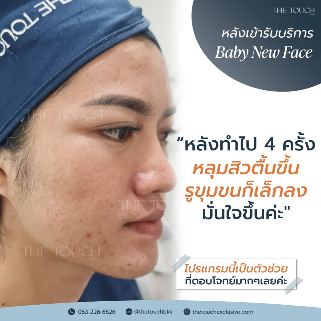 review-baby-new-face