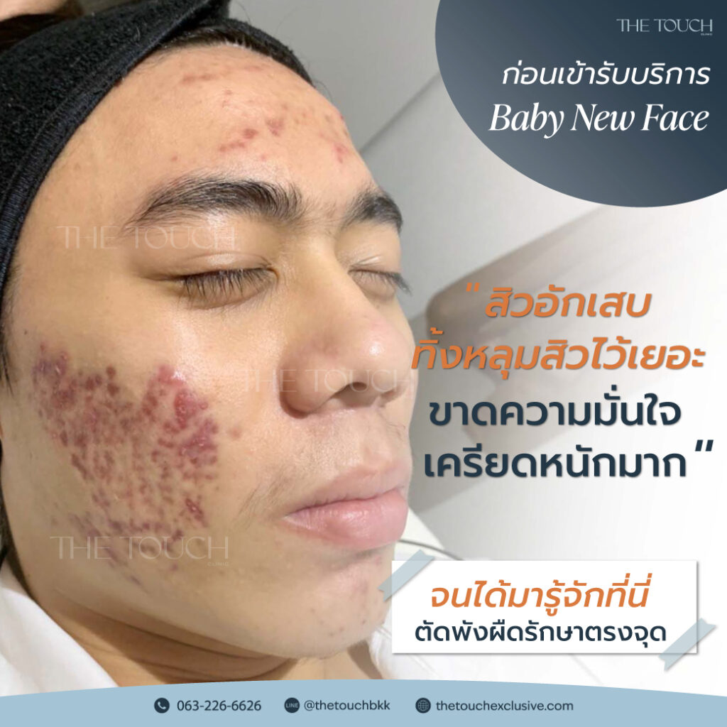 review-baby-new-face