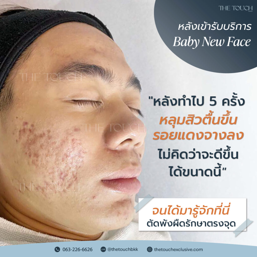 review-baby-new-face