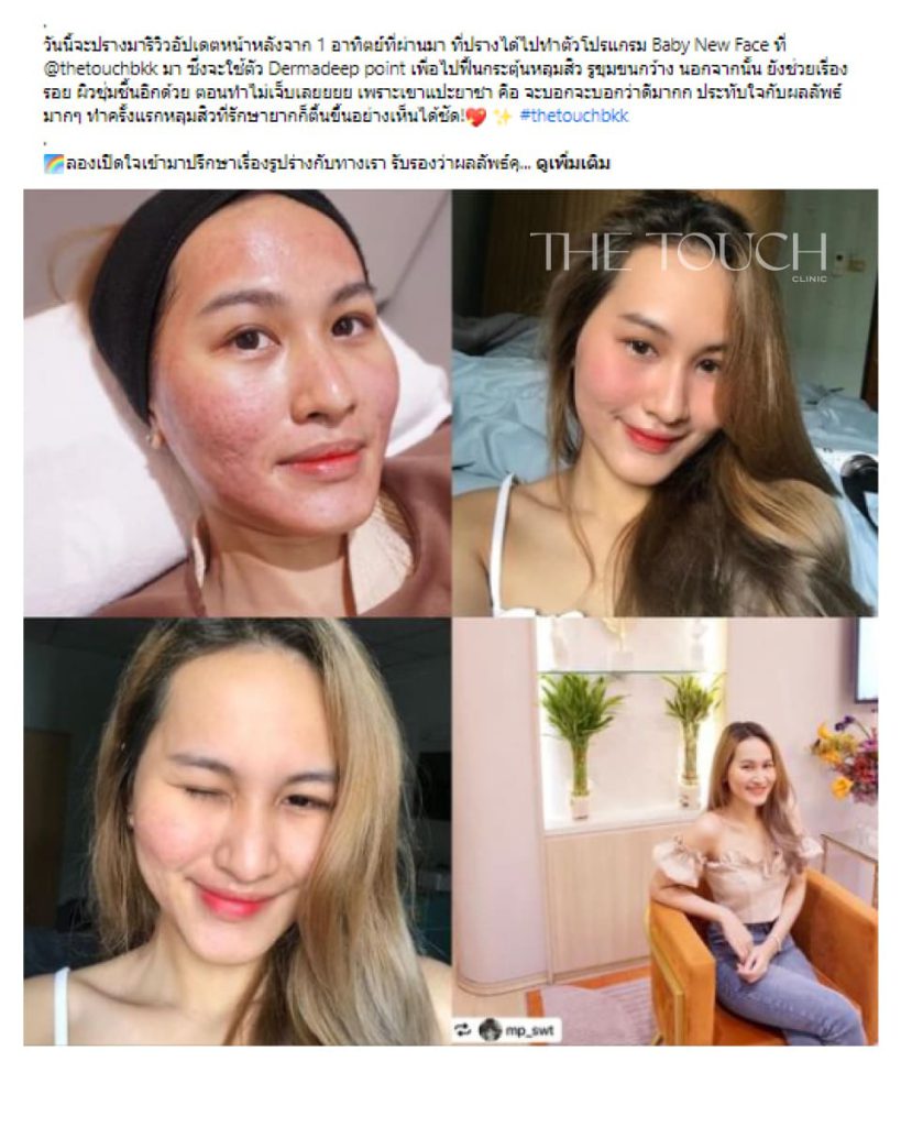 review-baby-new-face