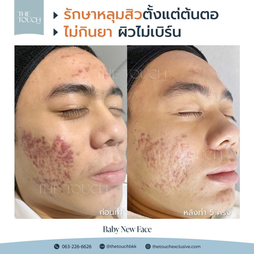 review-baby-new-face