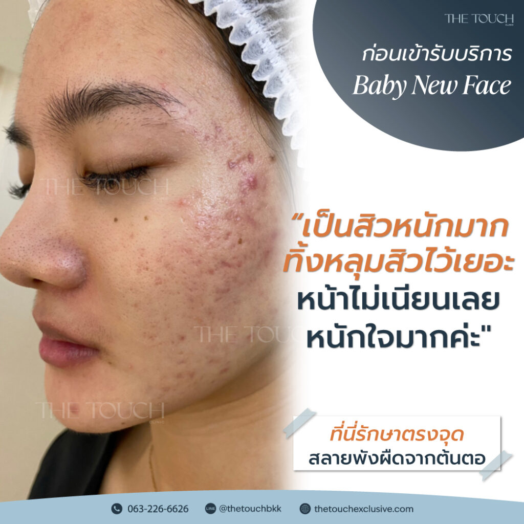 review-baby-new-face