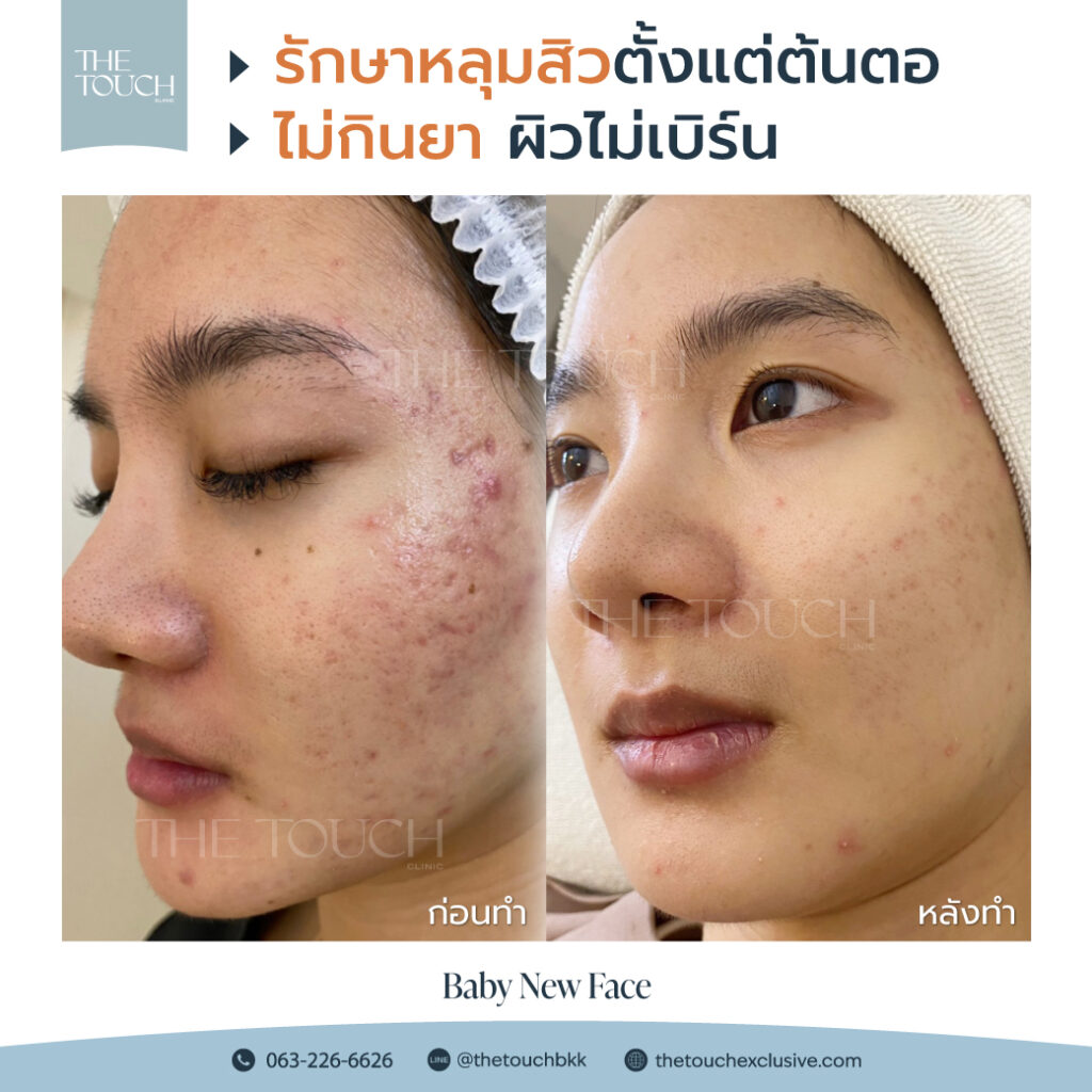 review-baby-new-face