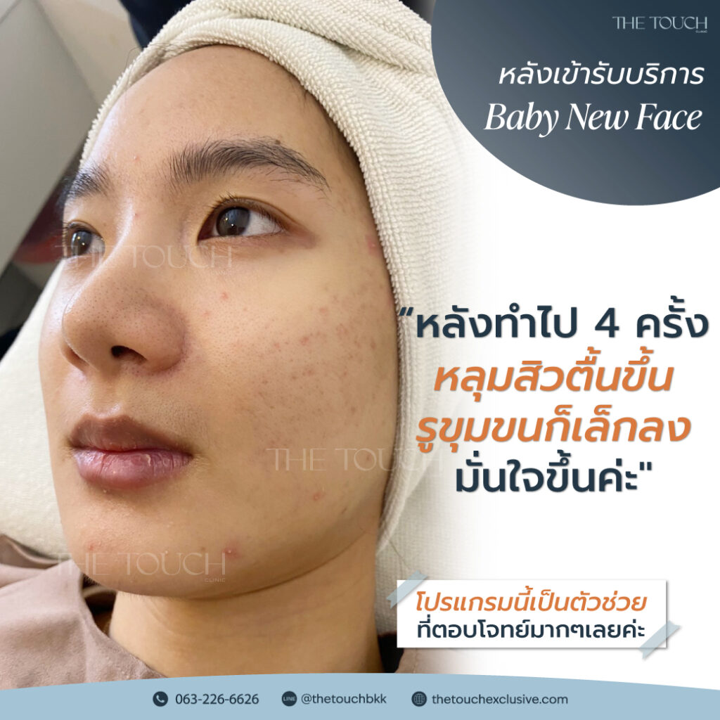 review-baby-new-face
