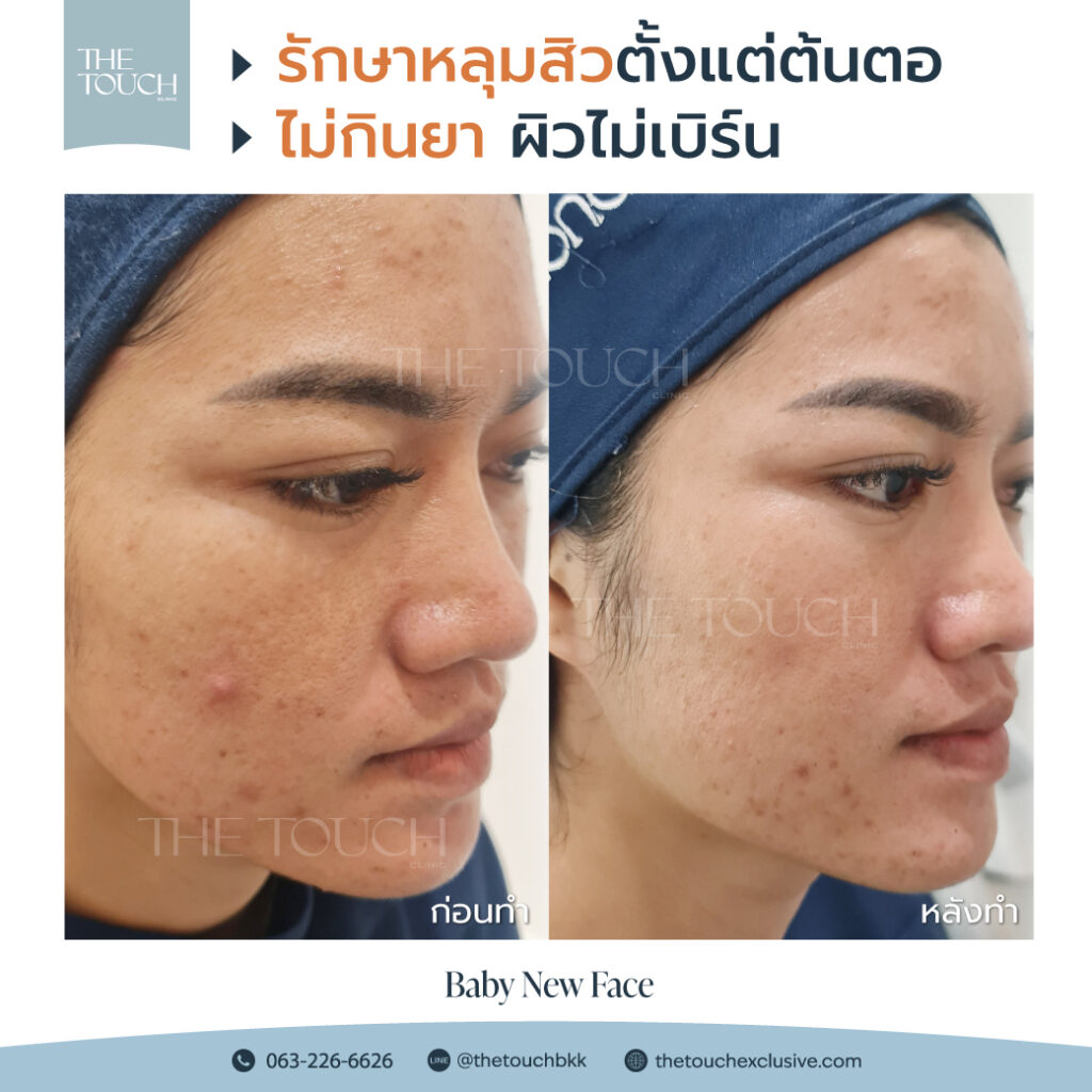 review-baby-new-face