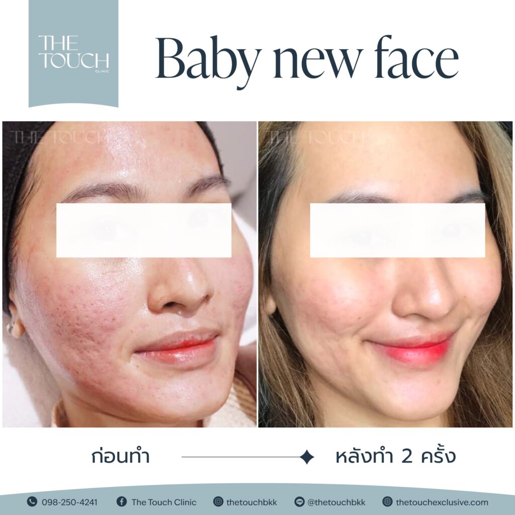 review-baby-new-face