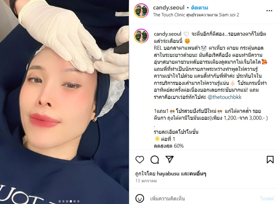 review-rf-eye-lifting