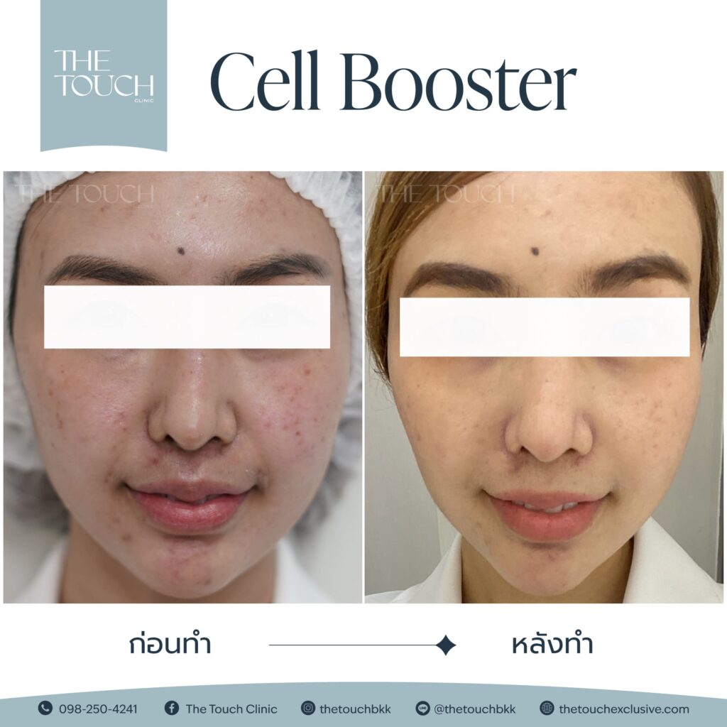 cell booster