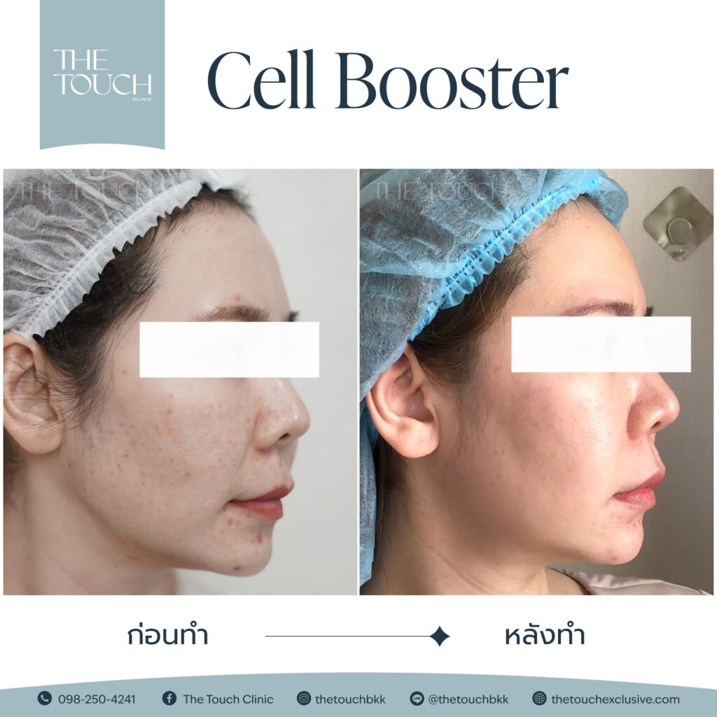 cell booster