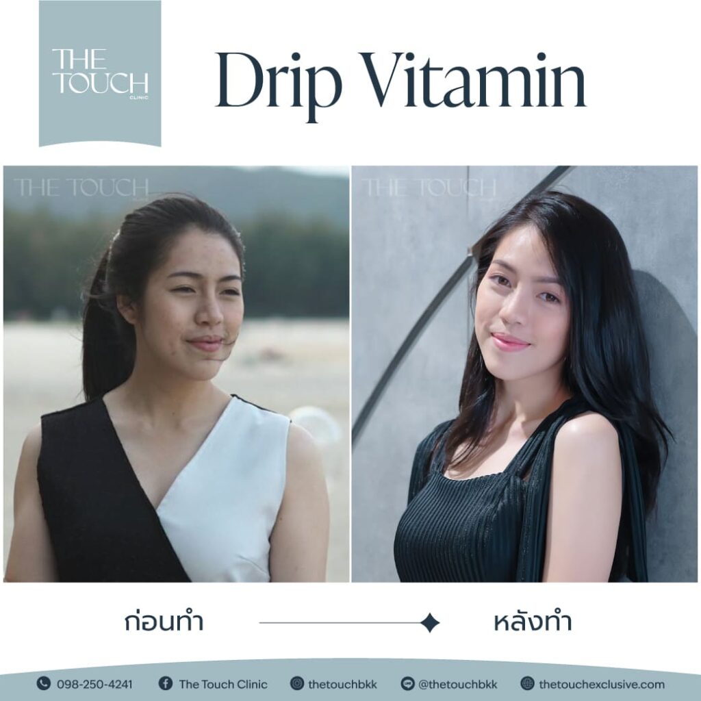 review-iv-drip-vitamin