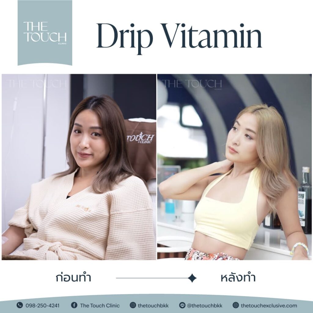 review-iv-drip-vitamin