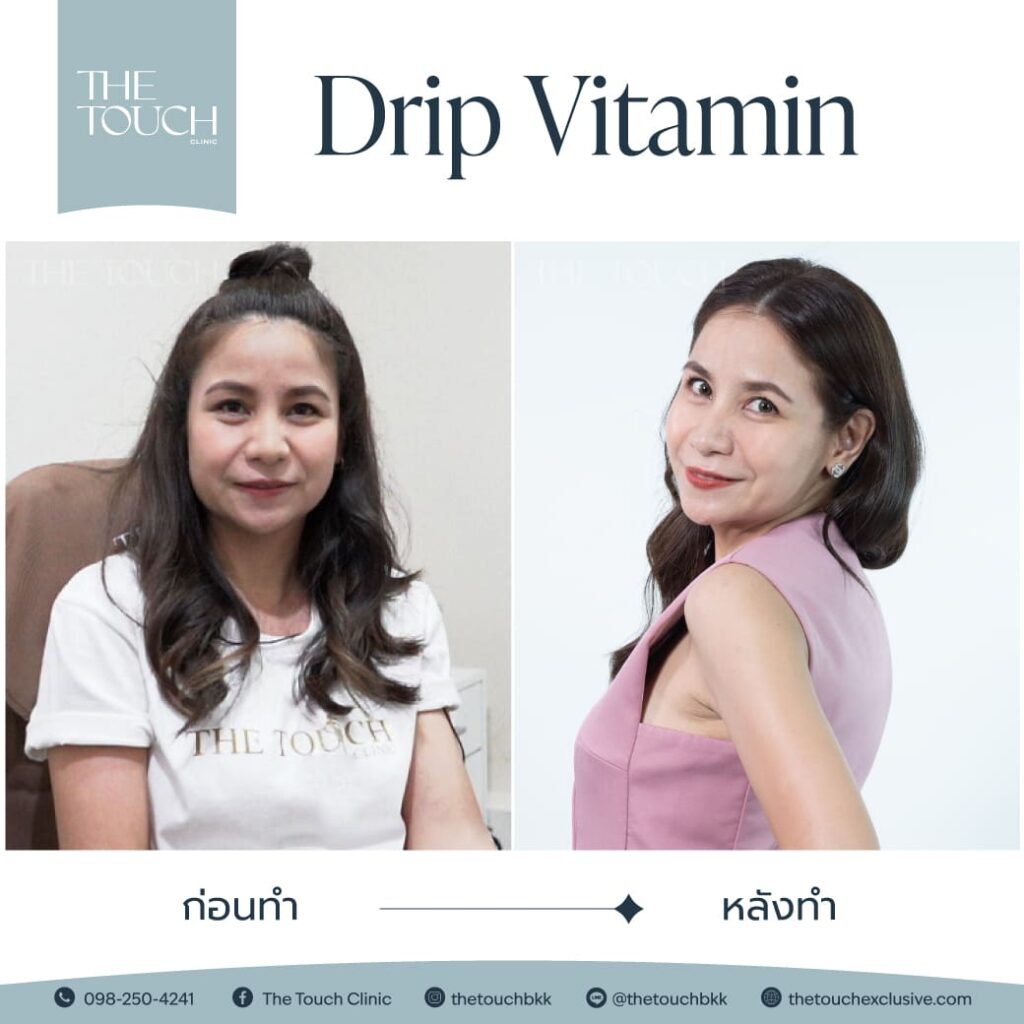 review-iv-drip-vitamin