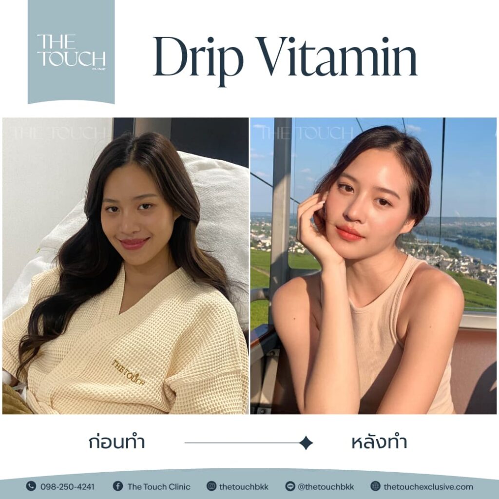 review-iv-drip-vitamin