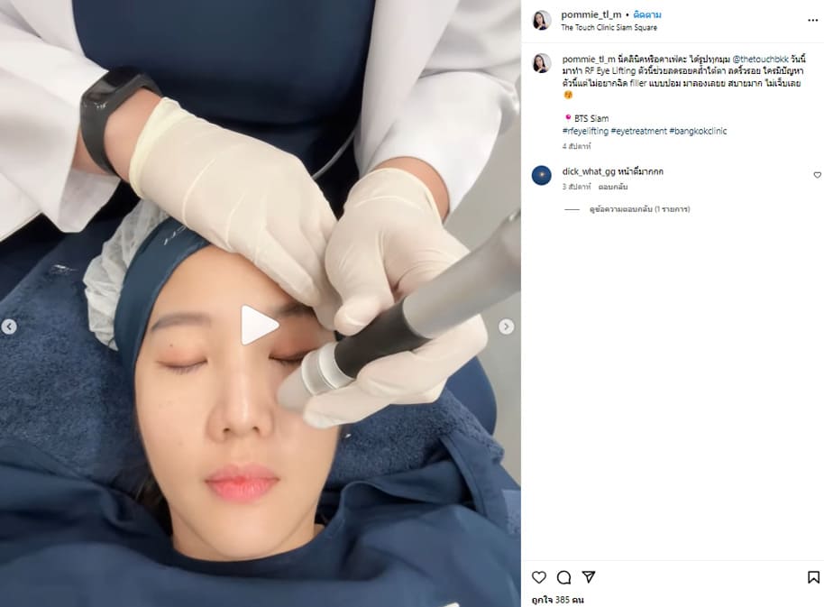 review-rf-eye-lifting