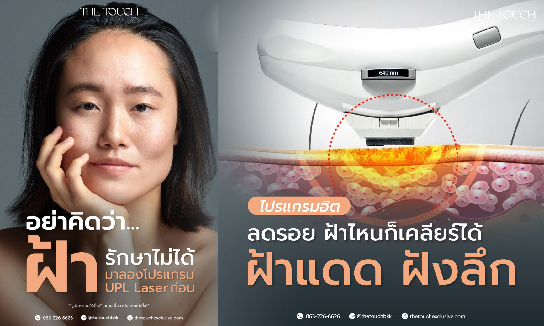 review-upl-ultimate-intensive-pulse-light