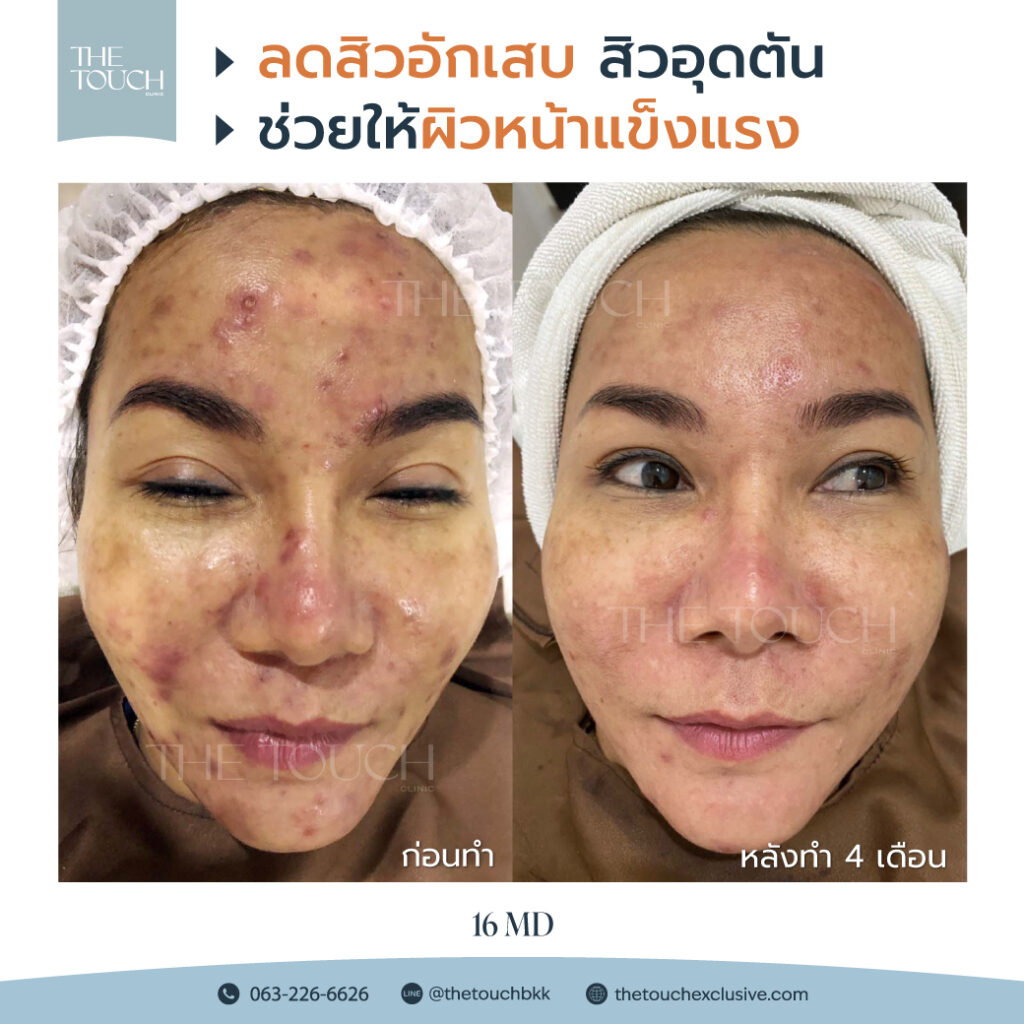 review-16-md-มาเด้-คอลลาเจน