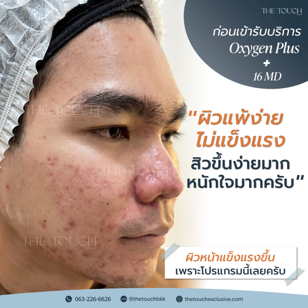 review-16-md-มาเด้-คอลลาเจน