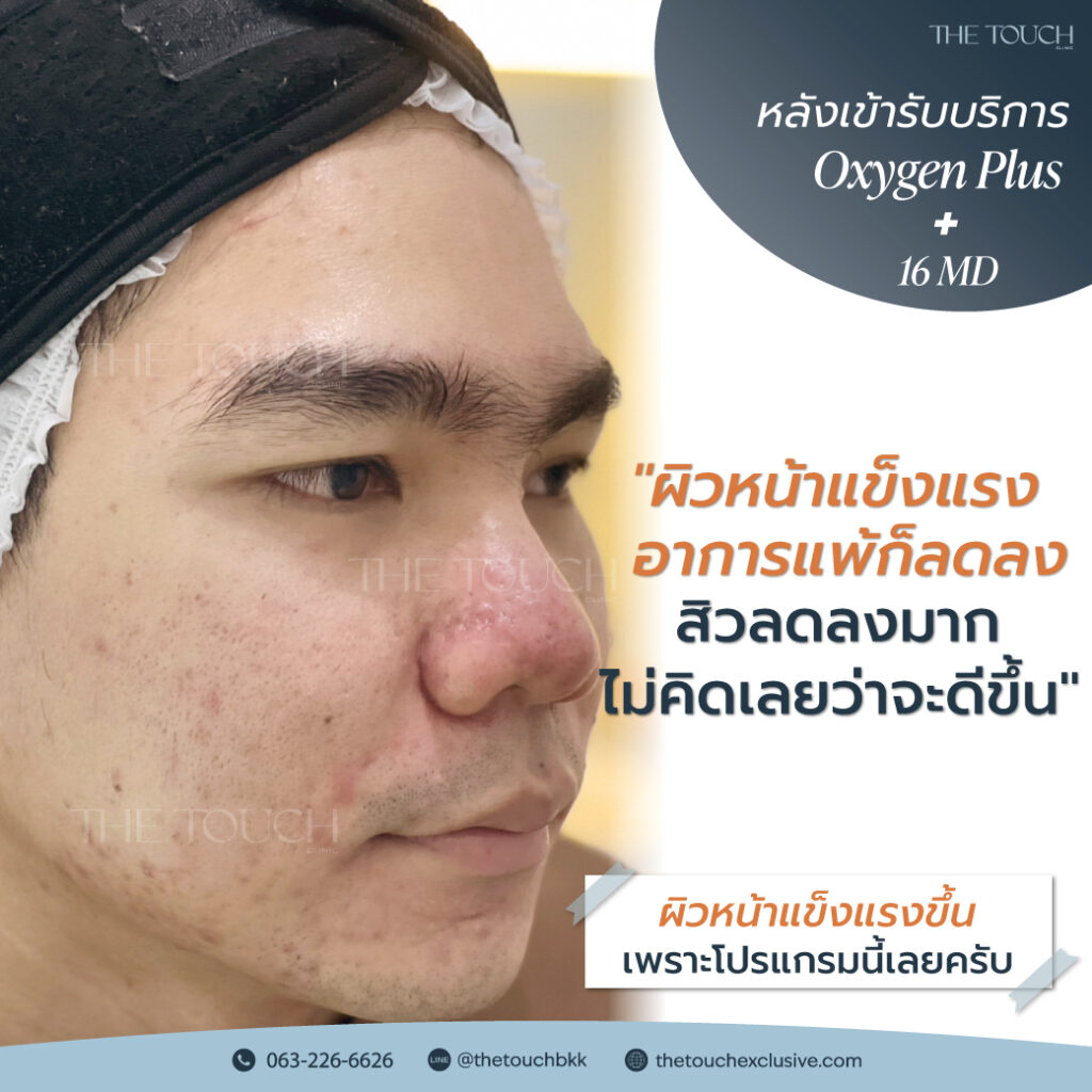 review-16-md-มาเด้-คอลลาเจน