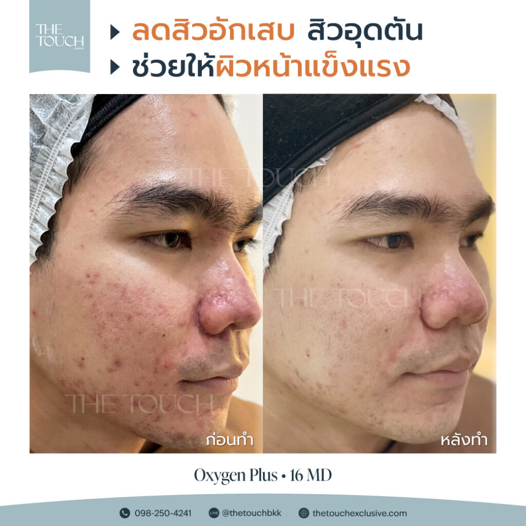 review-16-md-มาเด้-คอลลาเจน