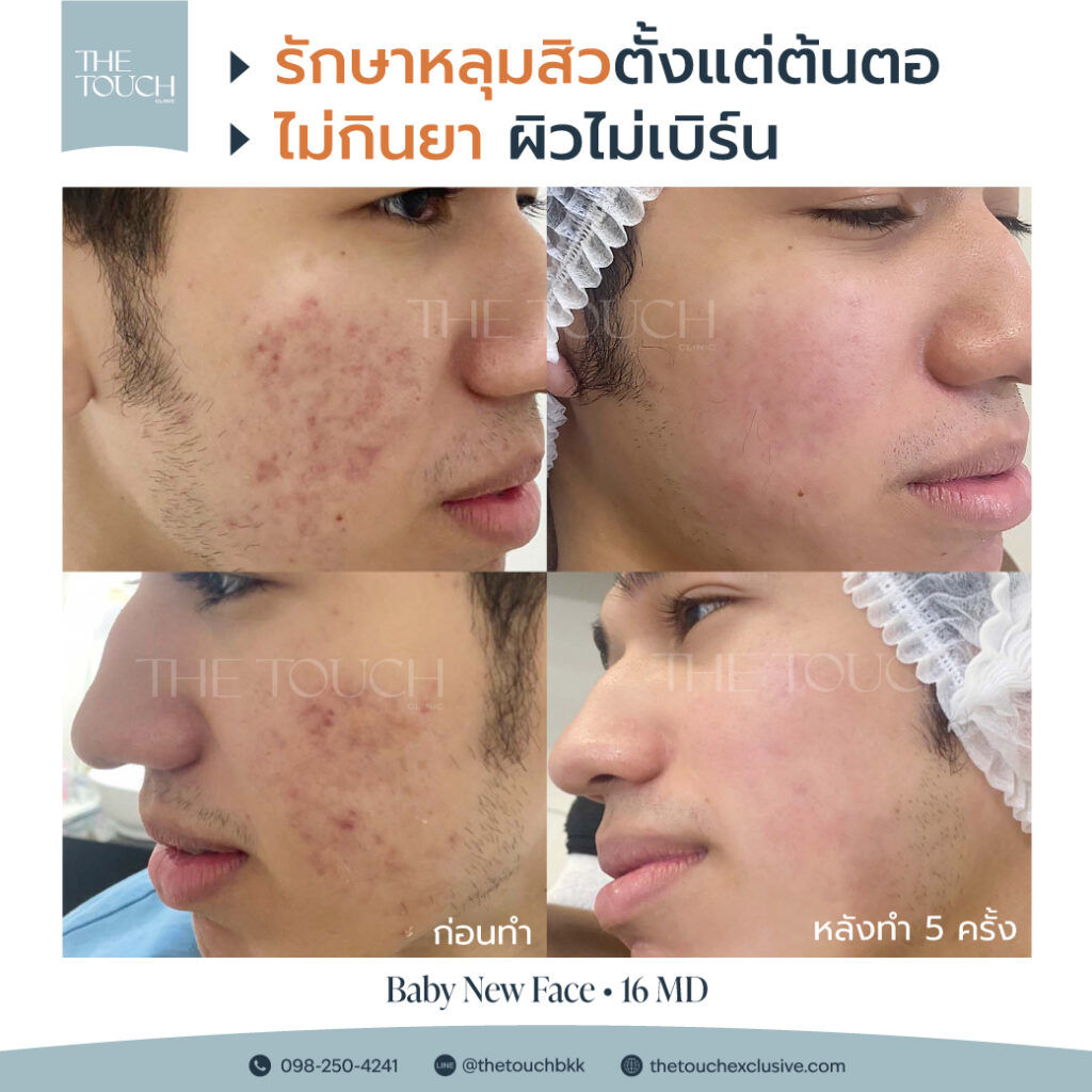 review-16-md-มาเด้-คอลลาเจน