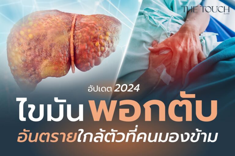 ไขมันพอกตับ ภัยเงียบในคนไทย ยุค 2024 อันตรายใกล้ตัวที่คนมองข้าม