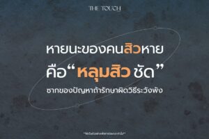ปัญหาหลุมสิว ความท้าทายของผิวที่ไม่เพียงจบแค่การรักษาสิว