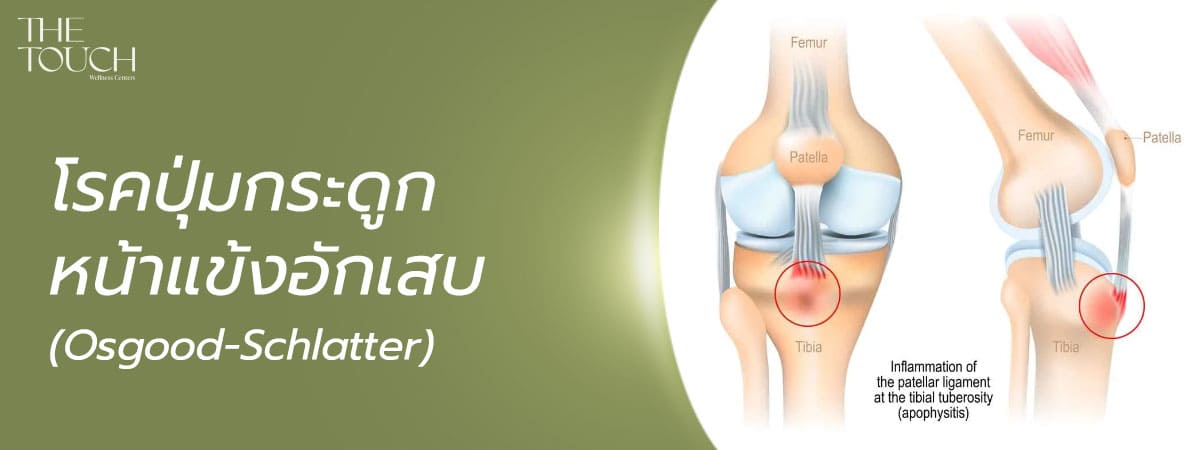 ปวดเข่าจากการเล่นกีฬา