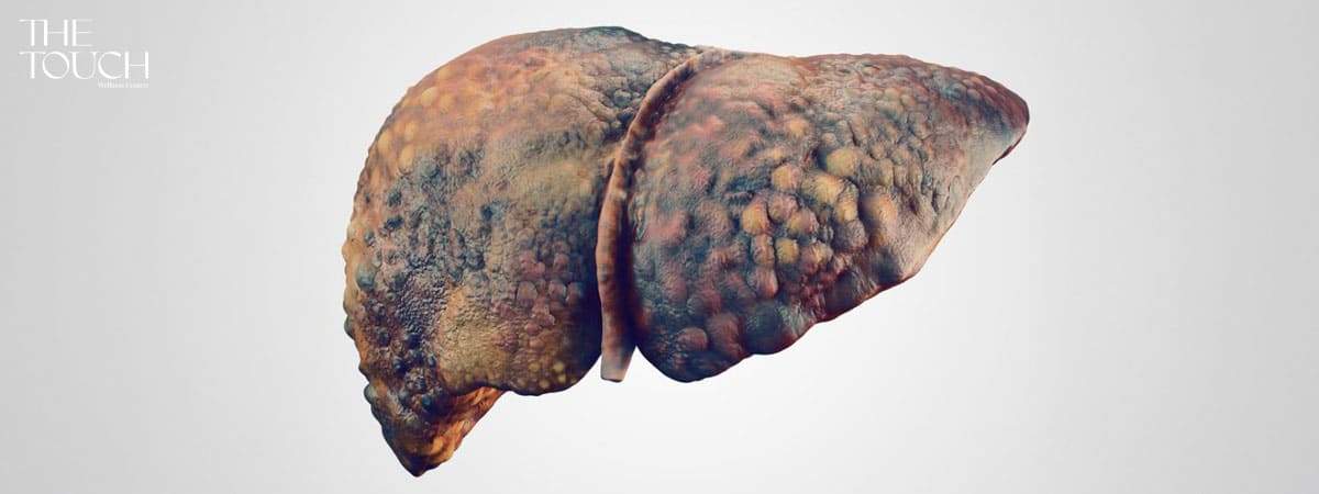 สุขภาพตับ