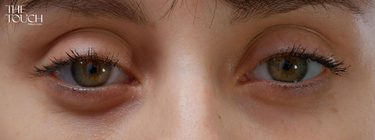 ร้องไห้