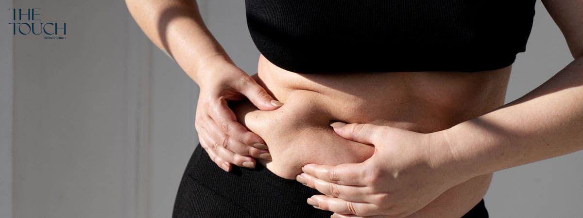 โรคอ้วน