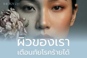ใครจะคิดว่า “ผิวของเรา” เตือนภัยโรคร้ายได้ถึงขั้นนี้
