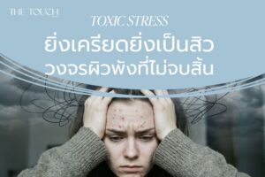 TOXIC STRESS ยิ่งเครียดยิ่งเป็นสิว วงจรผิวพังที่ไม่จบสิ้น