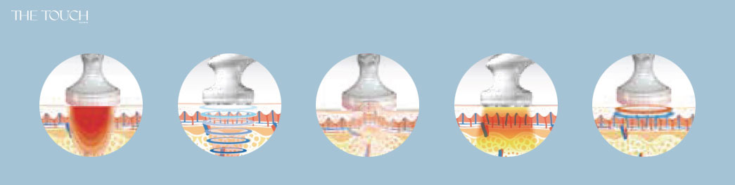 ผิวเรียบเนียน