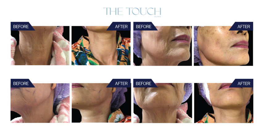 หน้าเด็ก