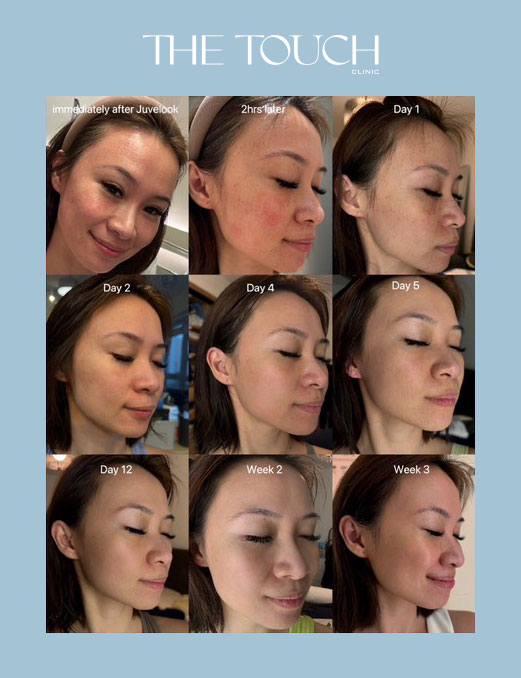 ผิวเรียบเนียน