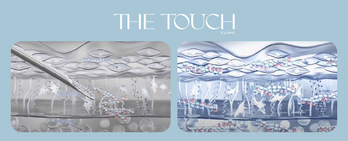 ลดริ้วรอย