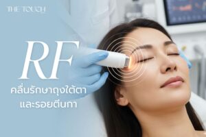 คลื่น RF รักษาถุงใต้ตาและรอยตีนกา: คู่มือคนมีริ้วรอย