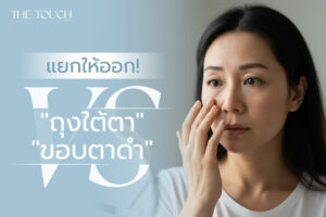 สาเหตุที่แท้จริงของถุงใต้ตา (Eye Bags) คืออะไรกันแน่?