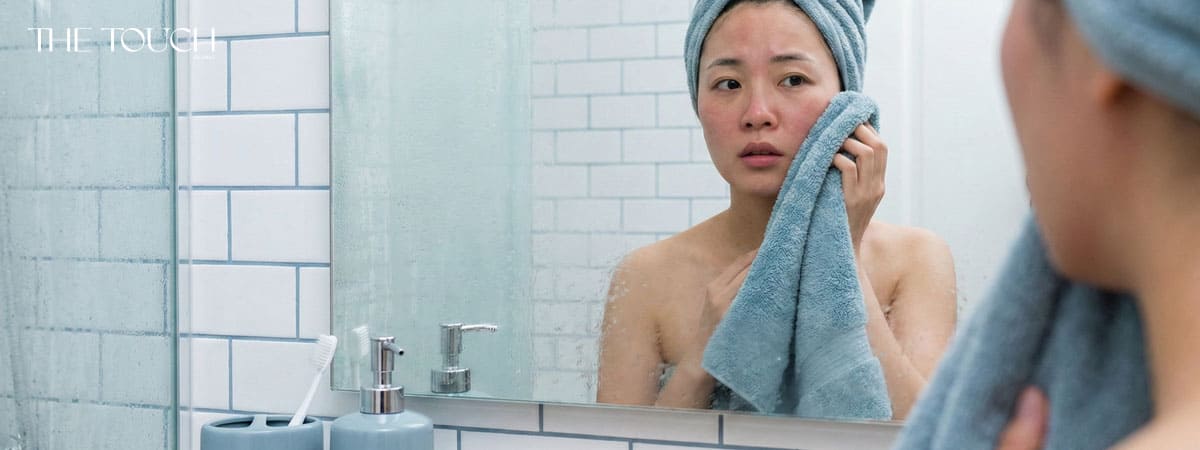 ผิวขาดน้ำ