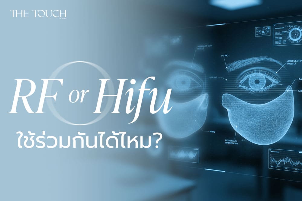 มีปัญหาถุงใต้ตา ใต้ตาคล้ำ ทำ RF และ HIFU ร่วมกันได้ไหม?