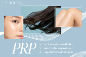 prp (Platelet Rich Plasma) คืออะไร? นวัตกรรมฟื้นฟูเซลล์ด้วยเกล็ดเลือดเข้มข้น