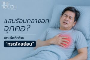 แสบร้อนกลางอก จุกคอหอย! เจาะลึก “กรดไหลย้อน” ความทรมานของคนวัยทำงาน